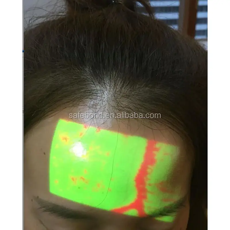 Medical Projection Infrared Vein Scanner Vein Imaging Device Medical Injection Auxiliary Equipment,blood Analysis System CE ISO vein imaging device vein viewing Vein Viewer Vein Viewer Instrument Medical Vein Finder Vein Finder Device Vein Finder