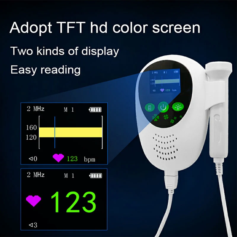 Professional Fetal Doppler Portable Ultrasound Baby Heart Doppler Fetal Monitor
