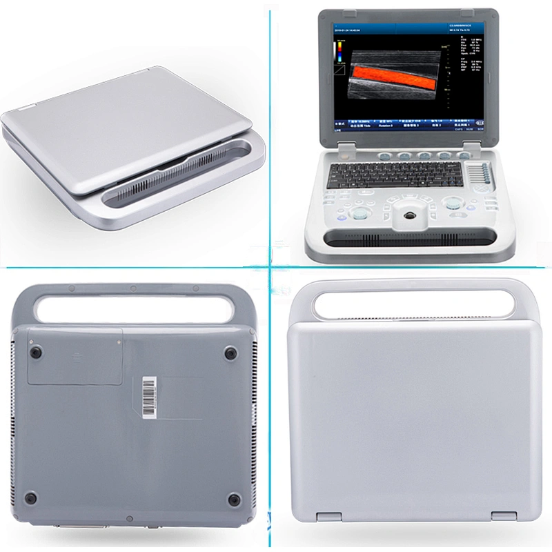 On-site blood chemistry analyzer machine fully automatic blood chemistry analyzer veterinary