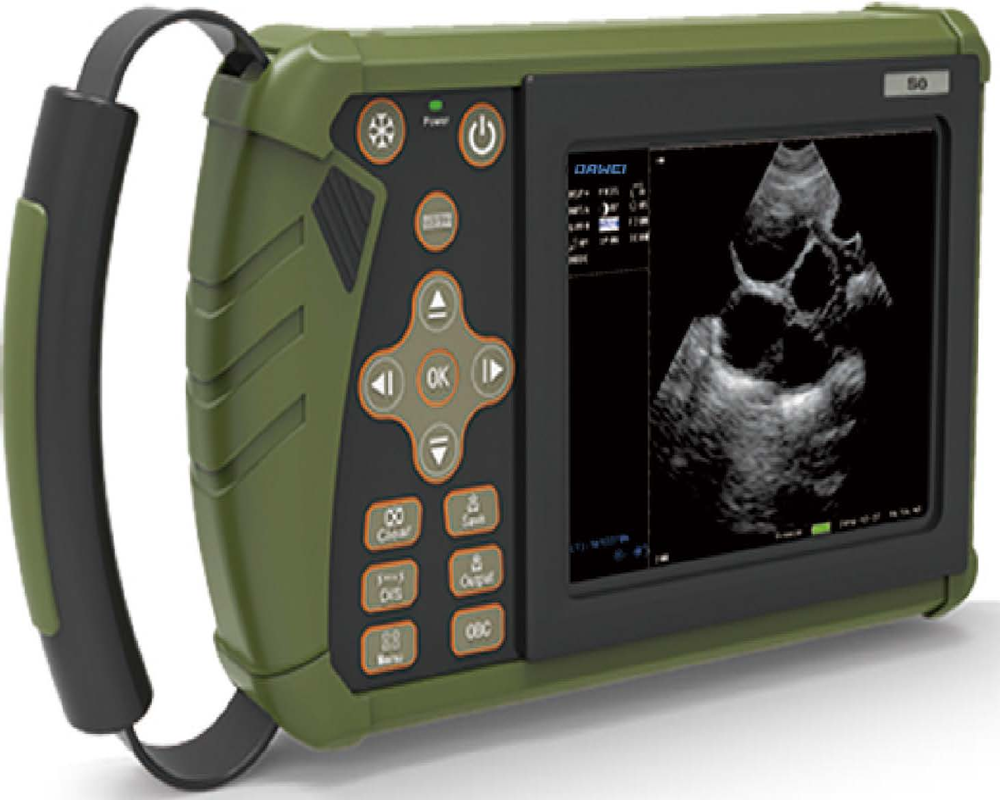ultrasound