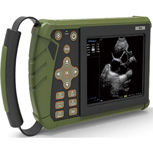 ultrasound