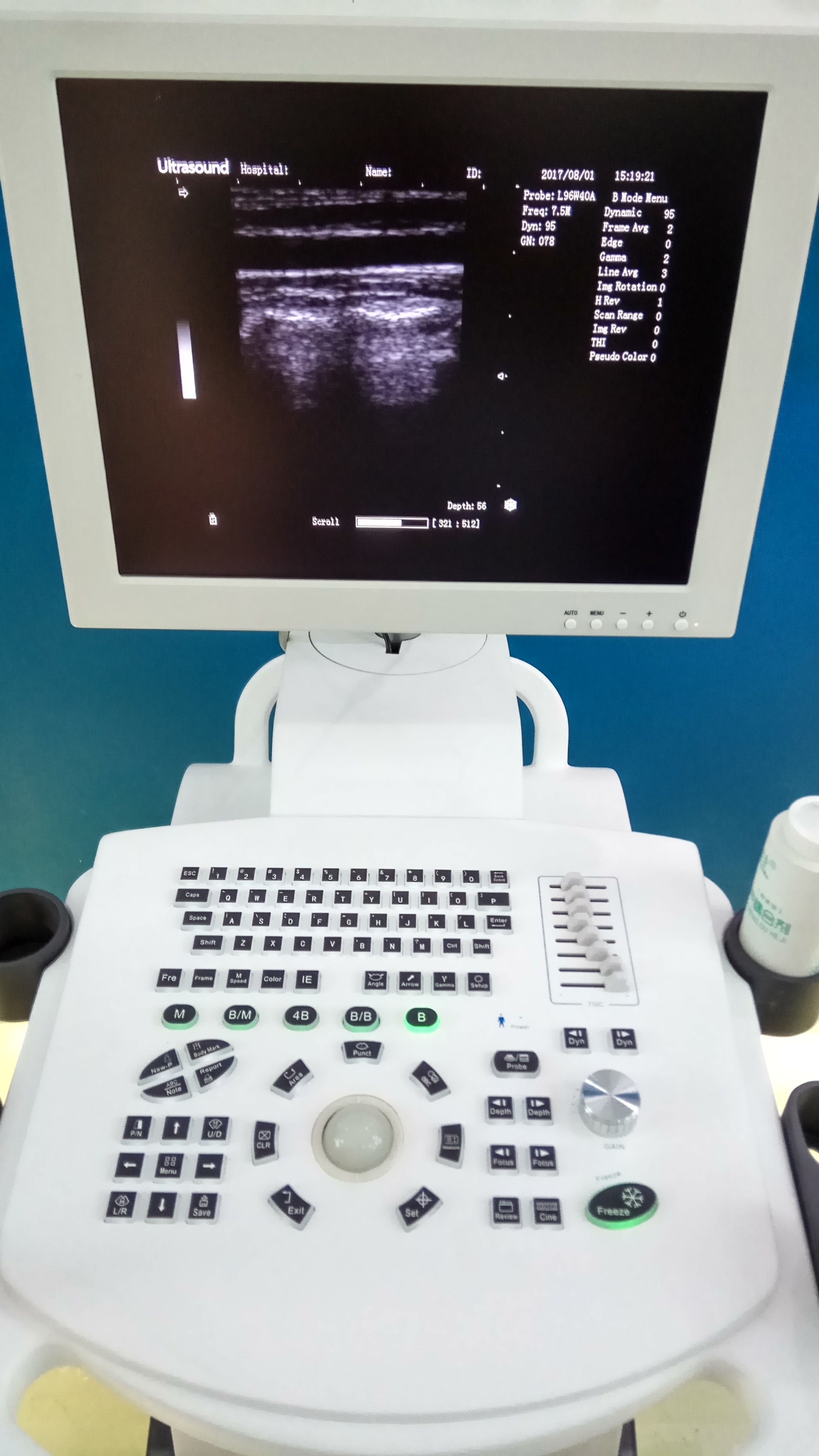 Ultrasound Machine