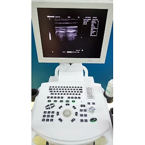 Ultrasound Machine