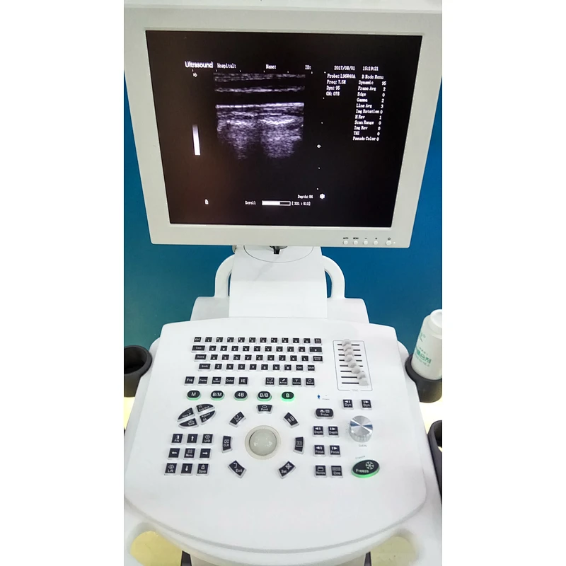 Ultrasound Machine
