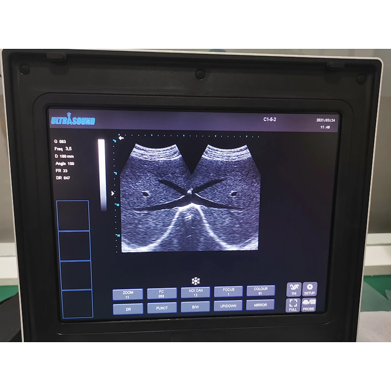 ultrasound machine