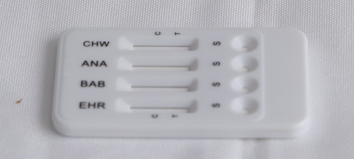 The Ehrlichia – Lyme - Anaplasma - Heartworm Combo Test
(TBD-4)