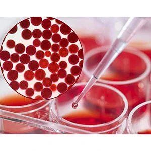 Haematococcus Pluvialis Extract