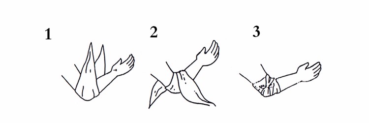 Triangular Bandage