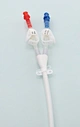 hemodialysis catheter