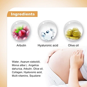 Skin Care Private Label Mango Pregnancy Stretch Mark Scars Removal Cream Anti Creme Pour Vergeture