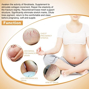 Skin Care Private Label Mango Pregnancy Stretch Mark Scars Removal Cream Anti Creme Pour Vergeture