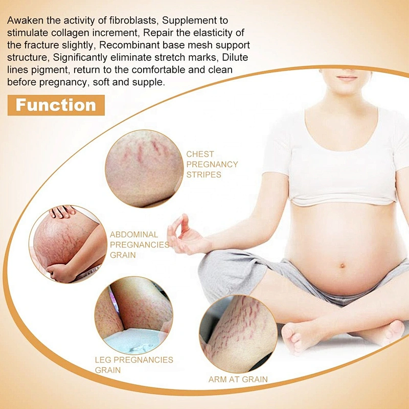 Skin Care Private Label Mango Pregnancy Stretch Mark Scars Removal Cream Anti Creme Pour Vergeture