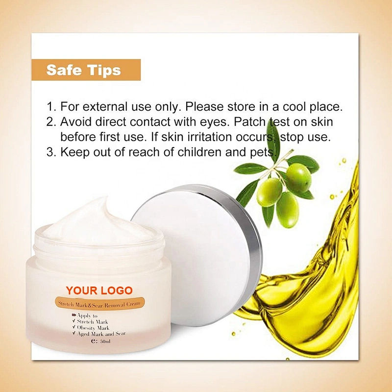 Skin Care Private Label Mango Pregnancy Stretch Mark Scars Removal Cream Anti Creme Pour Vergeture