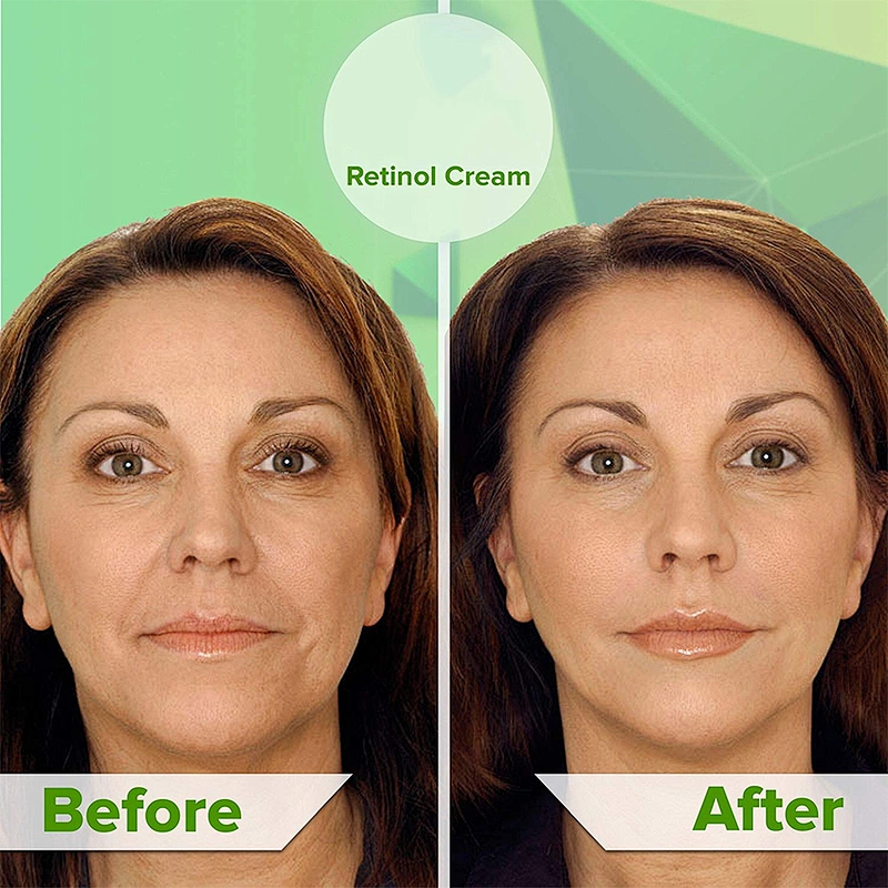 Private Label Whitening Vitamin C Face Cream