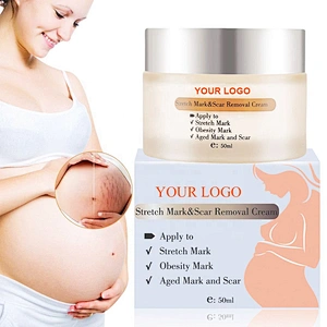 Skin Care Private Label Mango Pregnancy Stretch Mark Scars Removal Cream Anti Creme Pour Vergeture