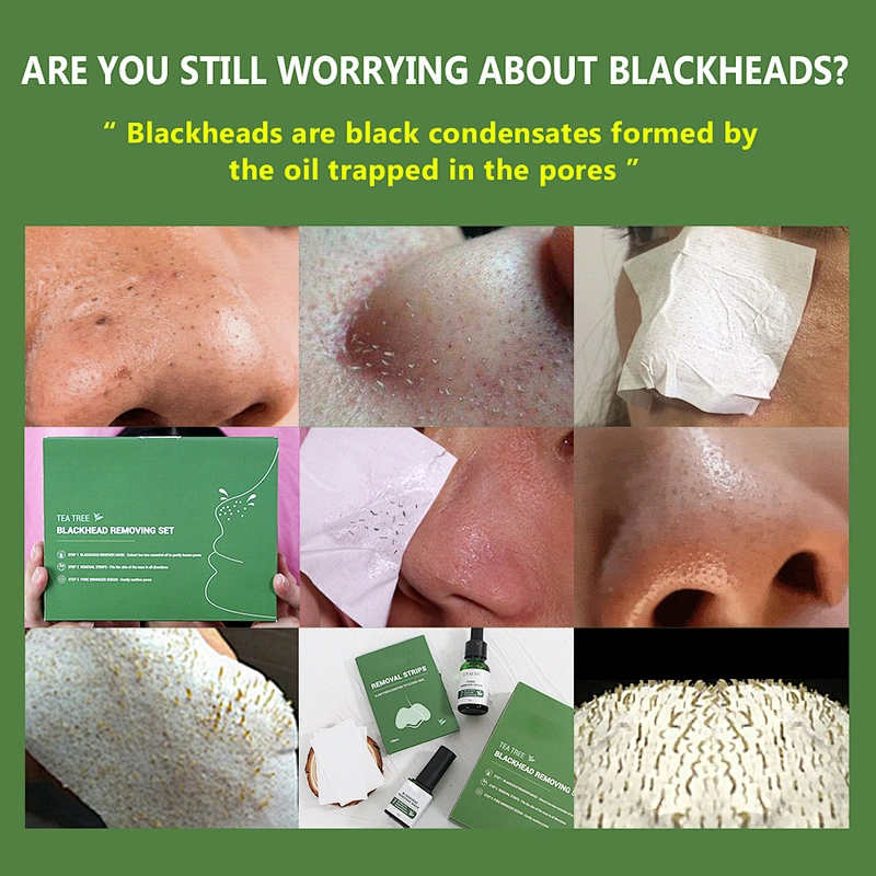 Private Label Remove Blackheads Skin Care Set
