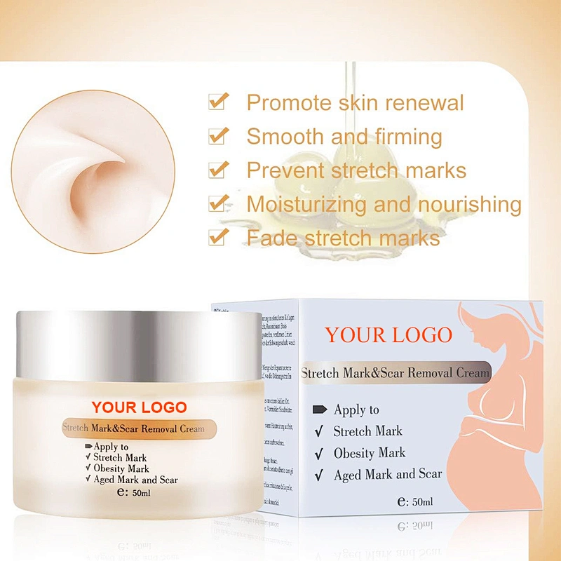 Skin Care Private Label Mango Pregnancy Stretch Mark Scars Removal Cream Anti Creme Pour Vergeture