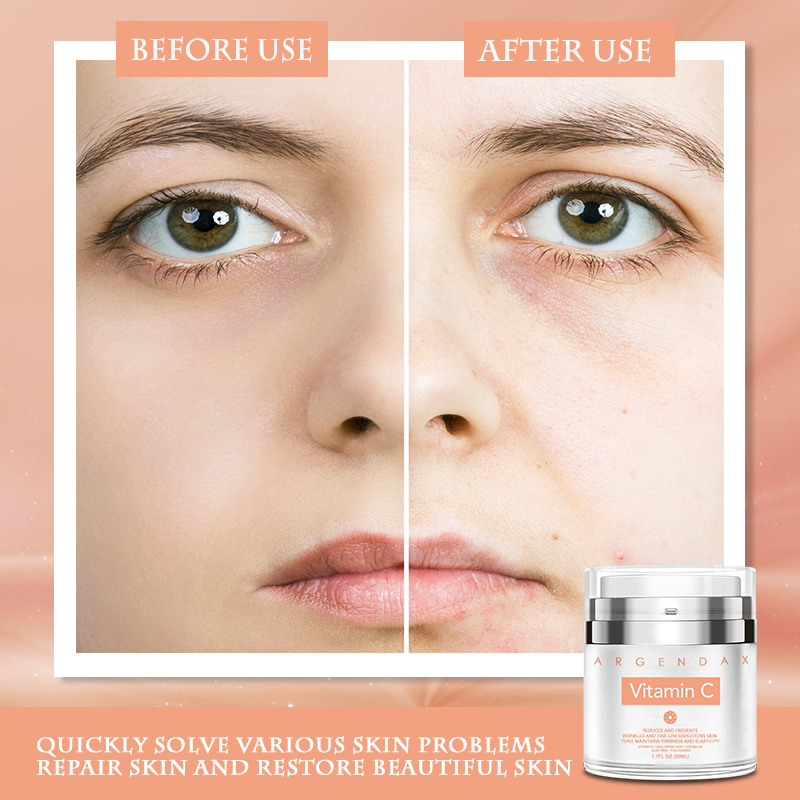 skin lightening cream wholesale,wholesale lightening cream,wholesale whitening cream,brightening cream wholesale,Goree whitening cream manufacturer