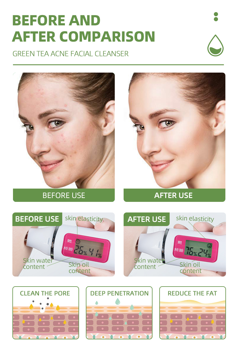 private label facial cleanser, wholesale facial cleanser, facial cleanser wholesale, wholesale silicone facial cleanser, wholesale amino acid facial cleanser