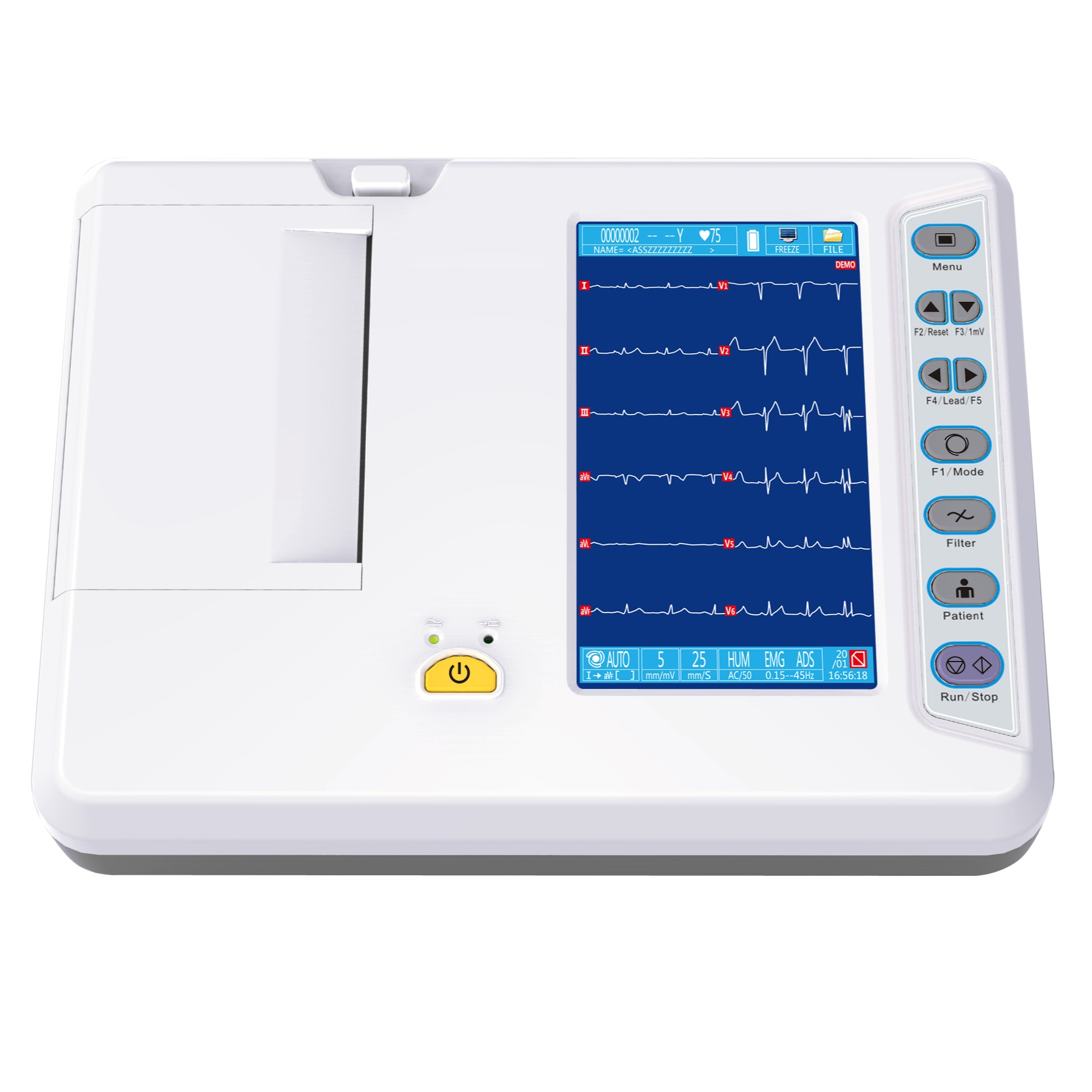 6-Channel Veterinary ECG Machine