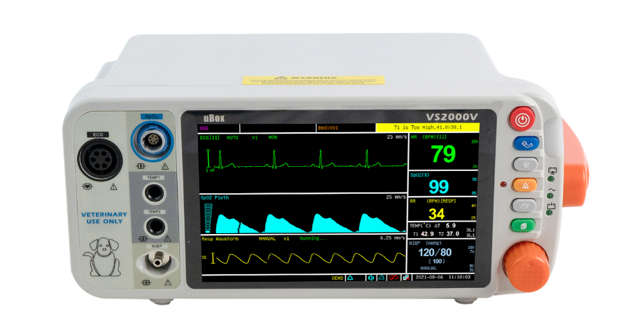 Pulse oximeter,  Patient Monitor, ICU monitor, oximeter, oximetre, utech-news