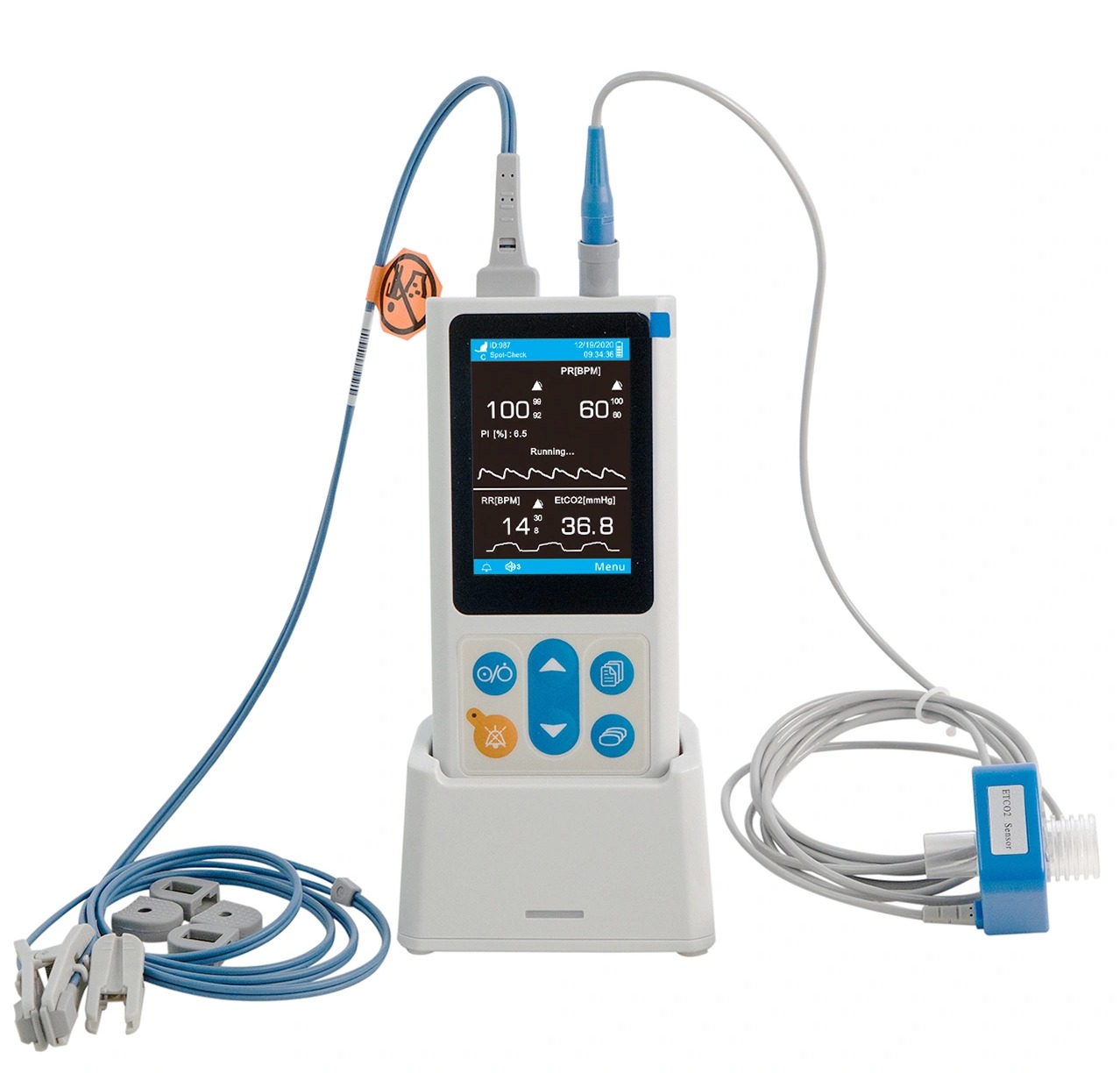uPM60VC Veterinary Vital Signs Monitor