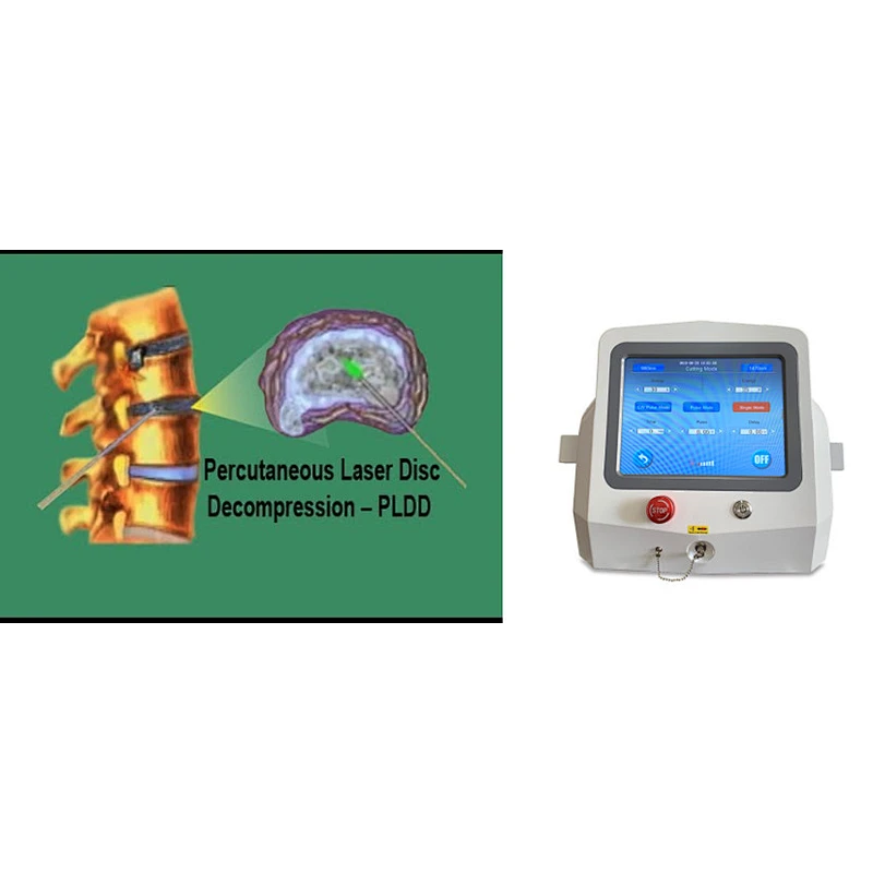 PLDD treatment laser surgery 1470 laser pldd