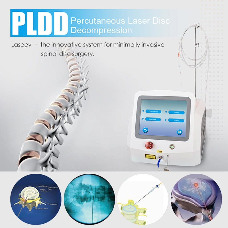 PLDD treatment laser surgery 1470 laser pldd