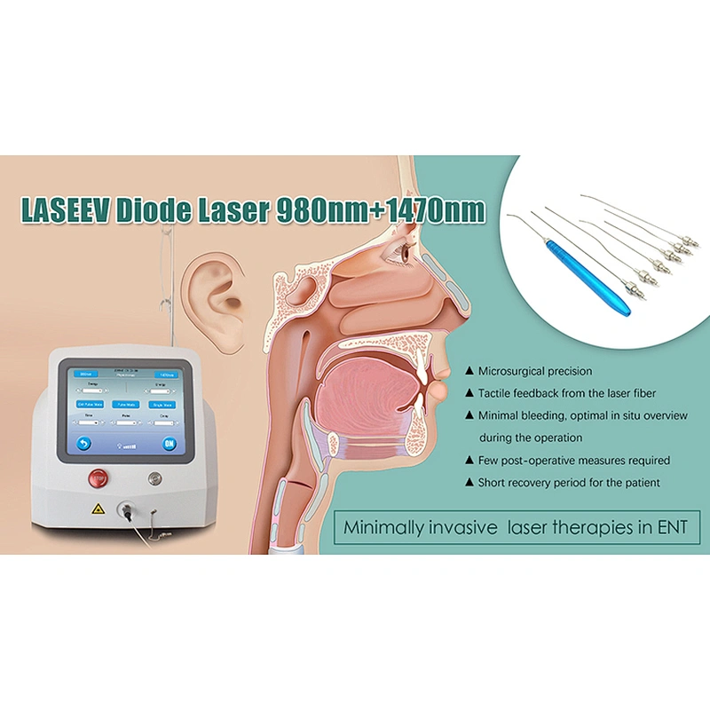 New Type 10 in 1 Class iv ENT Laser/EVLT Teeth Whitening Diode Laser Machine