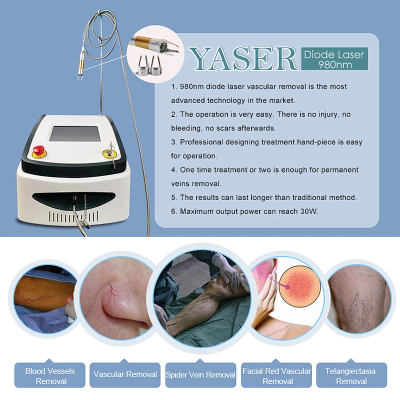 30w/60w Portable Spider Vein removal machine / Vascular Removal 980nm  diode laser 980 nm machine