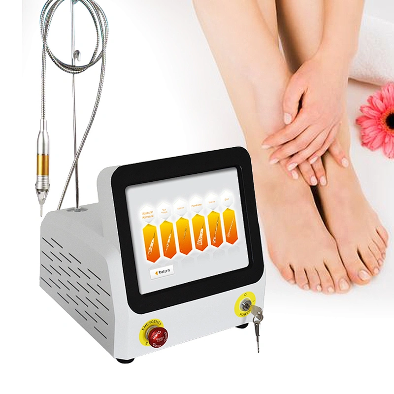 980nm laser nail fungus removal laser toe nail fungus laser podiatry