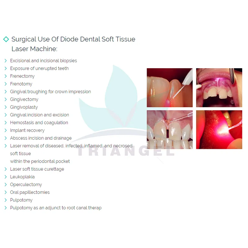 2024 Dental Laser 980nm diode laser soft tissue cutting laser CE Marked