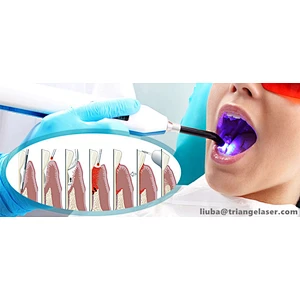 2024 Dental Laser 980nm diode laser soft tissue cutting laser CE Marked