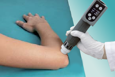shock wave therapy machine