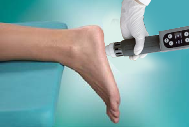 shock wave therapy machine