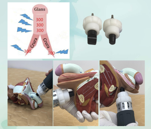 shock wave therapy machine