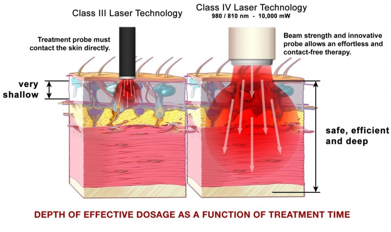 class iv laser therapy