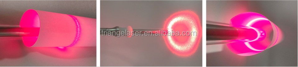 gynecological machine laser