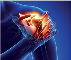 Class 4 physical therapy laser machine