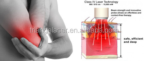 Class 4 physical therapy laser machine