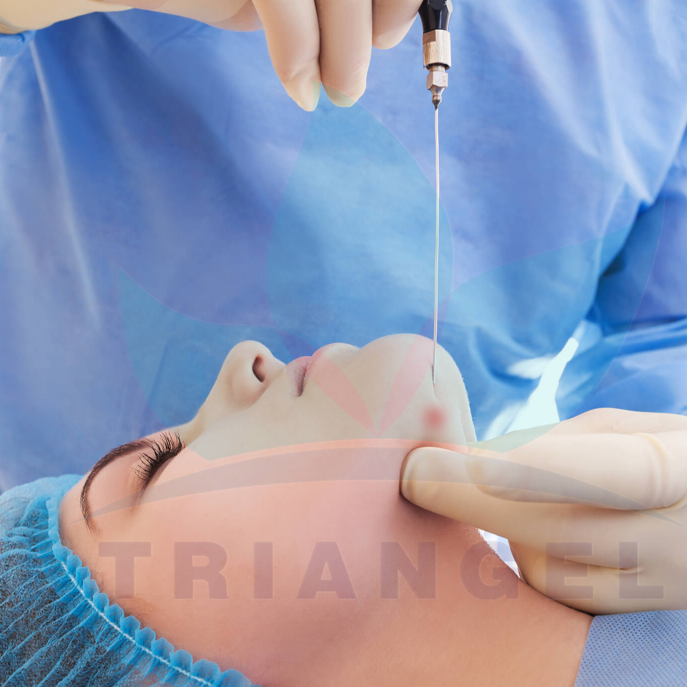 liposuction machine