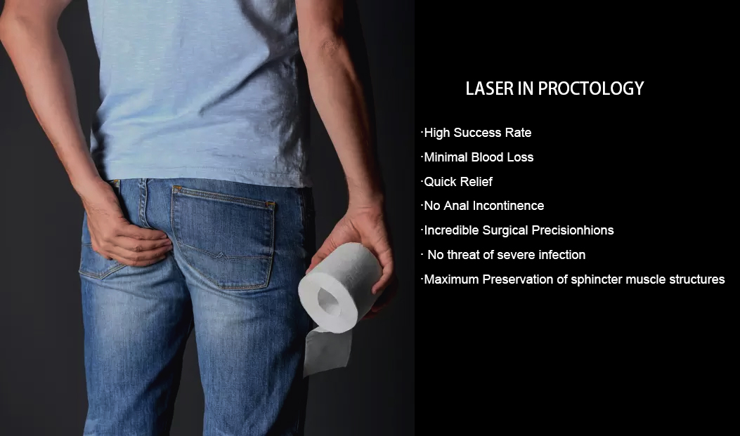 diode laser 980 1470 nm for hemorrhoid anal fistula hemorrhoid 