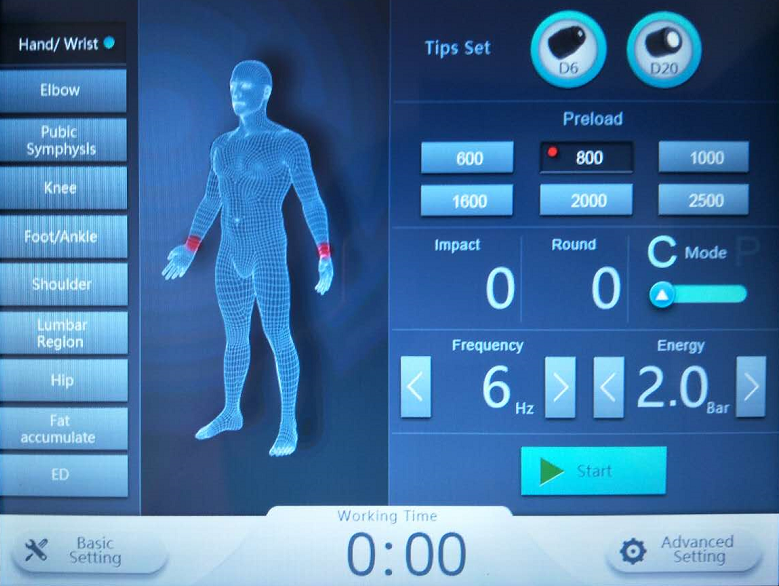 shock wave therapy equipment