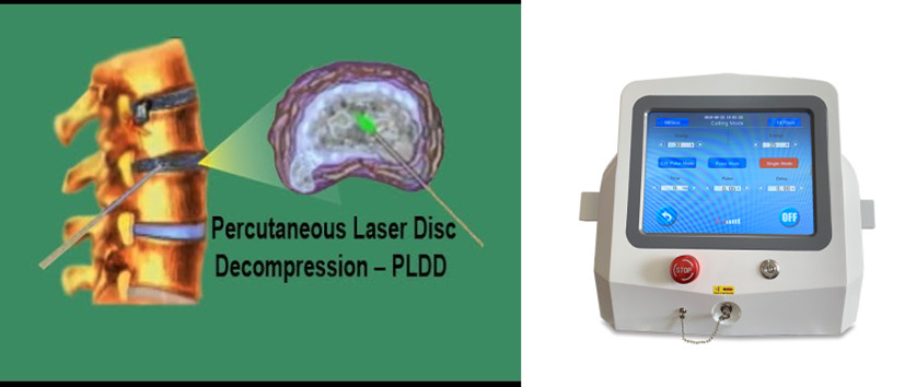 pldd laser device