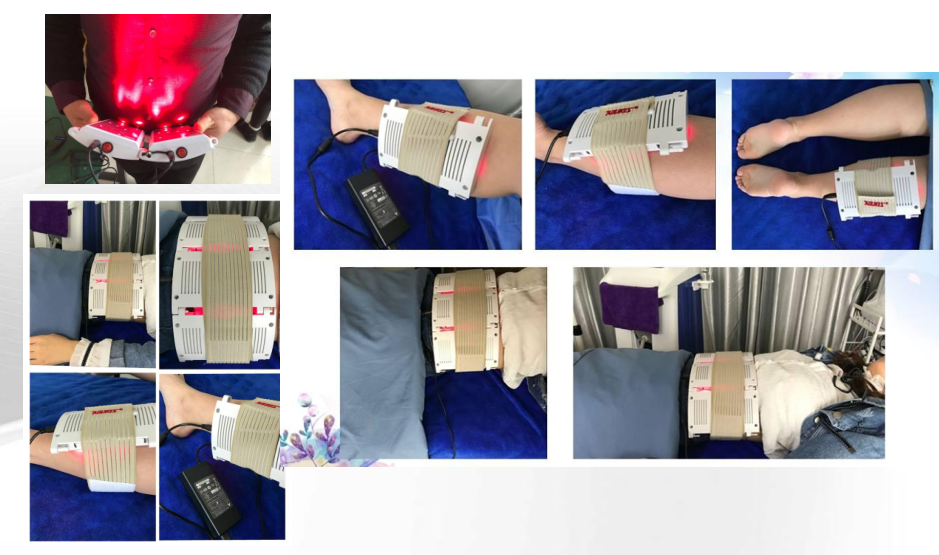 5d lipolaser body slimming