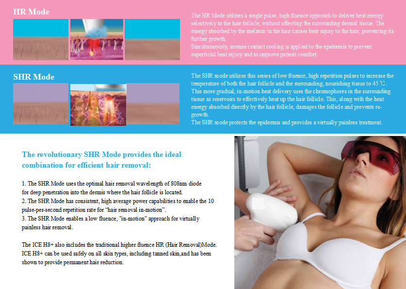 diode 808nm laser hair removal