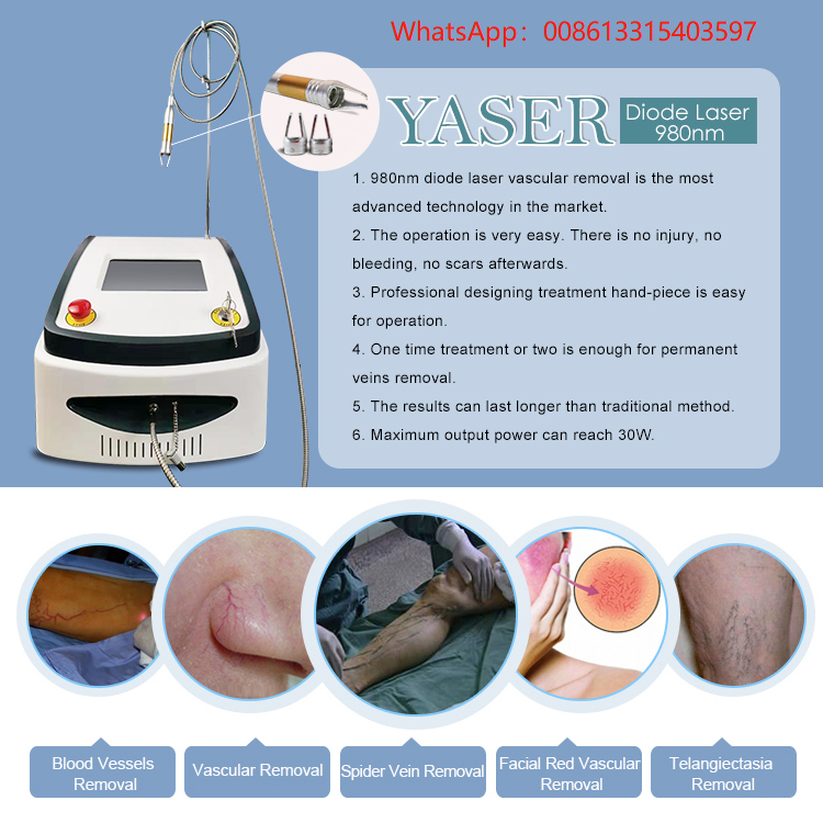 spider vein removal machine