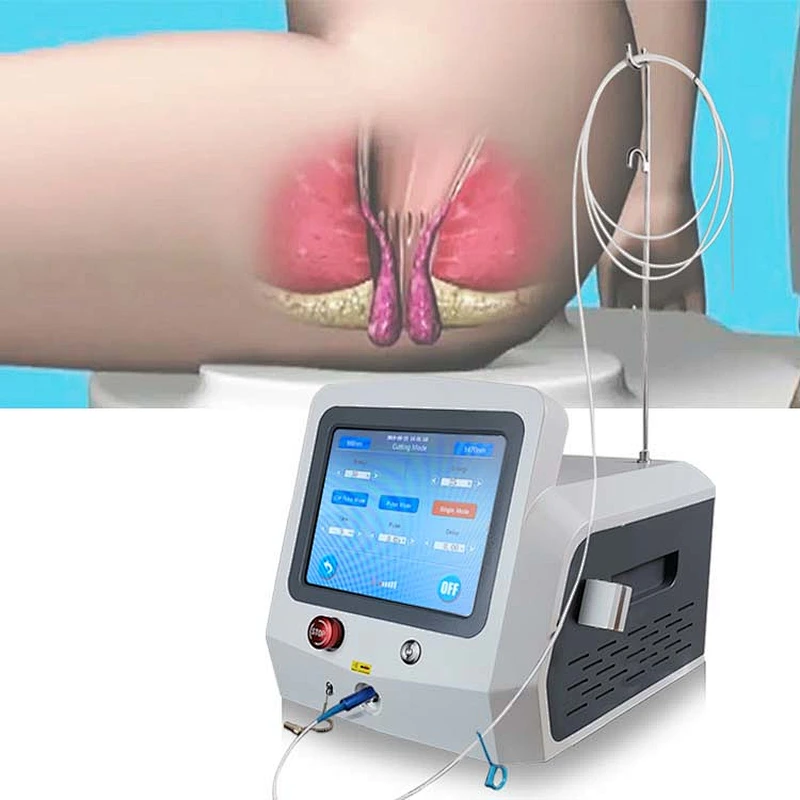 Dual Wave 980nm 1470nm Diode Laser Portable Equipment for Hemorrhoid Remove Proctological Trentment Piles