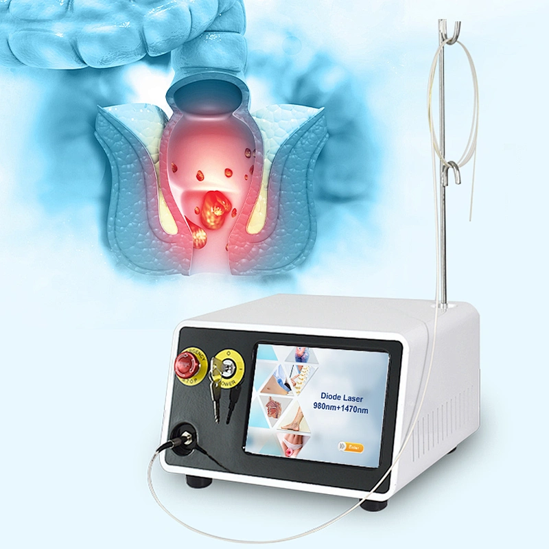 2025 New Hemorrhoid Treatment Surgery Laser Diode 980nm 1470nm Piles and Hemorrhoids Surgical Laser Device