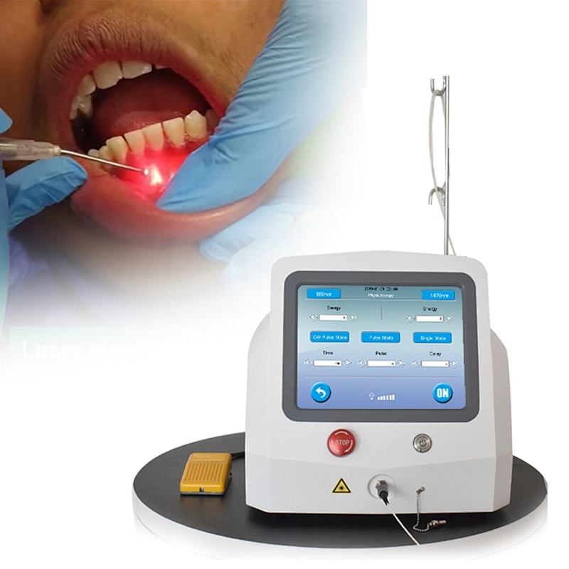 2024 Latest Medical Laser Dental 980nm 1470nm Dental Diode Laser Systems Teeth Whitening Machine